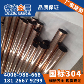 重庆304不锈钢圆管20*1.0mm 圆管拉丝抛光渡色 不锈钢水管焊管批